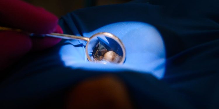 Clinica de medicină dentară DR TEO – Zâmbim oricând împreună: Obturația compozit